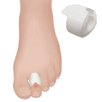 Προστατευτικός δακτύλιος gel | 07-2-041 (F041-31) | Wemed