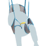 Σάκος Γερανού Full Body Comfort Standard | 0803123 | Wemed